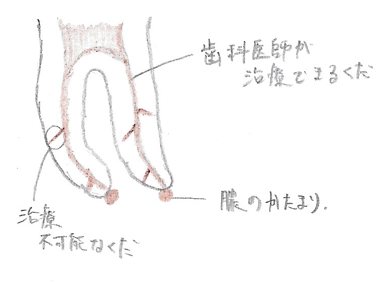 歯の画像です