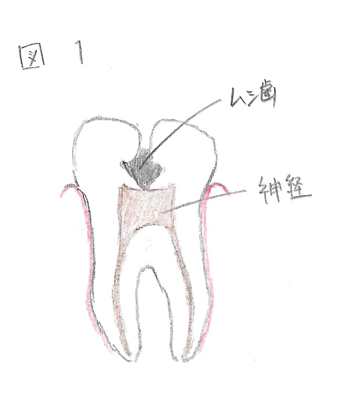歯の画像です
